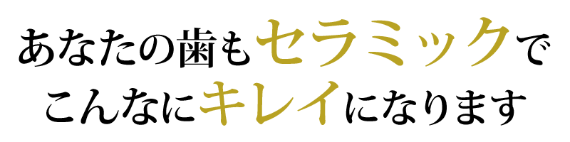 ���Ȃ��̎����Z���~�b�N�ł���ȂɃL���C�ɂȂ�܂�